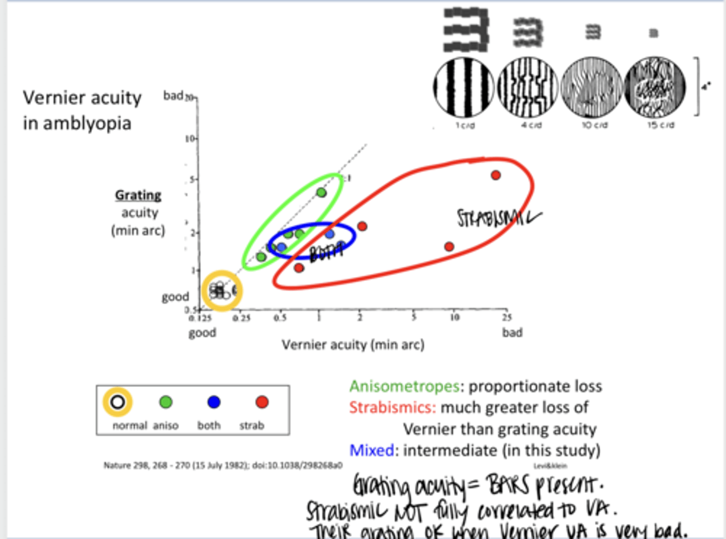<p>Vernier Acuity v Grating Acuity in a Strabismic Patient</p>
