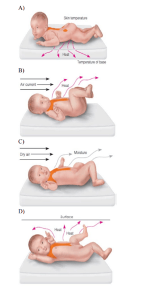 <p>36) The nurse is explaining the processes of infant heat loss to a new mother. Which diagram should the nurse use to describe the process of convection?</p>