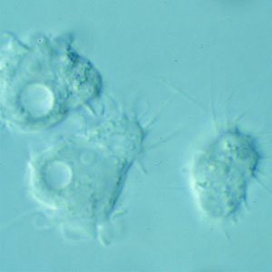 <p><span>spine-like processes</span></p>