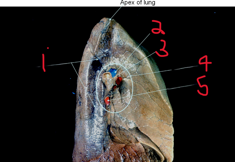 <p>What is depicted by #1</p>
