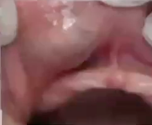 <p>what is the diagnosis </p>