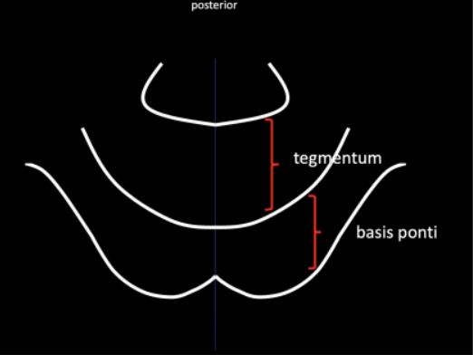 <p>Basis Ponti </p>