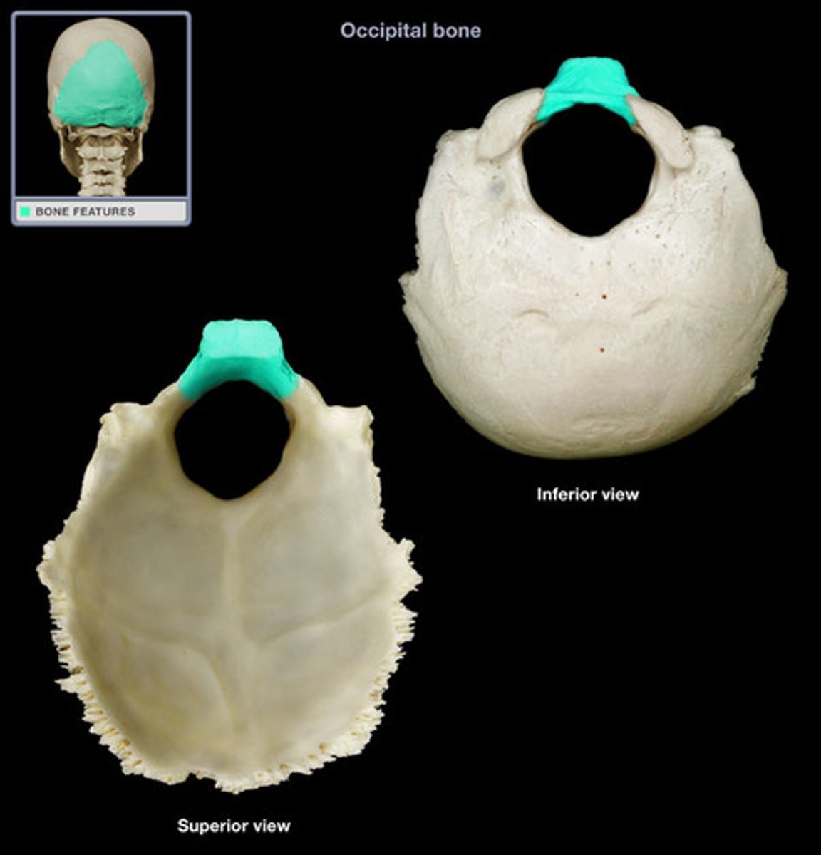 <p>This part is the thick, square projection anterior to the foramen magnum. It articulates with the petrous portions of both temporals and with the sphenoid via the basilar, or sphenooccipital suture.</p>