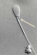 <p>Identify the sperm morphology.</p>