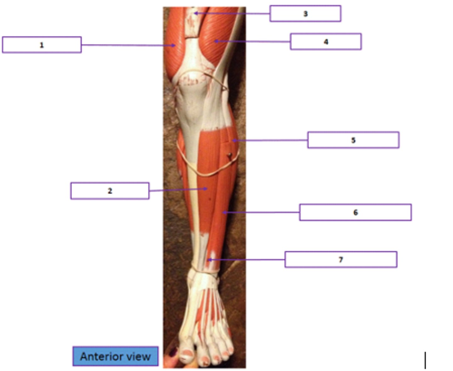 <p>Identify the muscle labeled 4.</p>