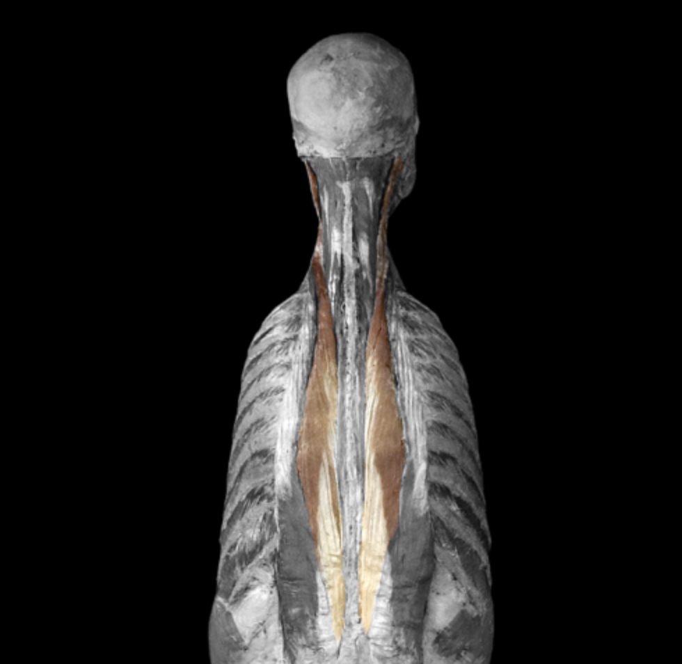 <p>What muscle is this?</p>