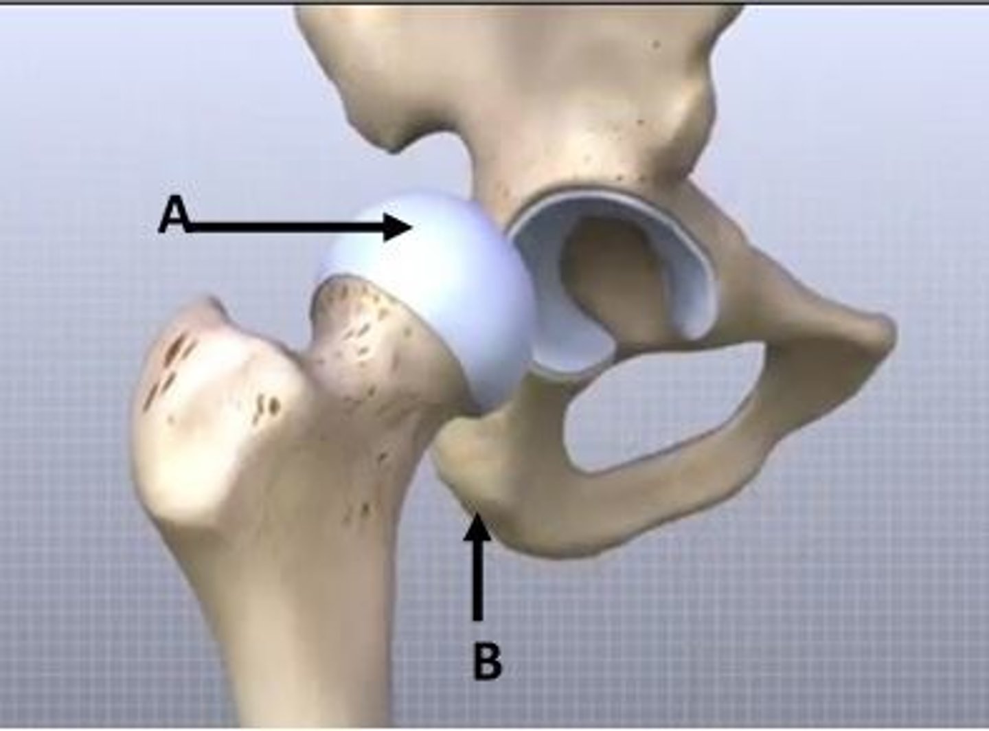 <p>With respect to the image shown, hyaline cartilage is indicated at A.</p><p>The landmark labelled B is called the ischial tuberosity. It is functionally significant in sitting position because it acts as a site for weight transmission.</p>