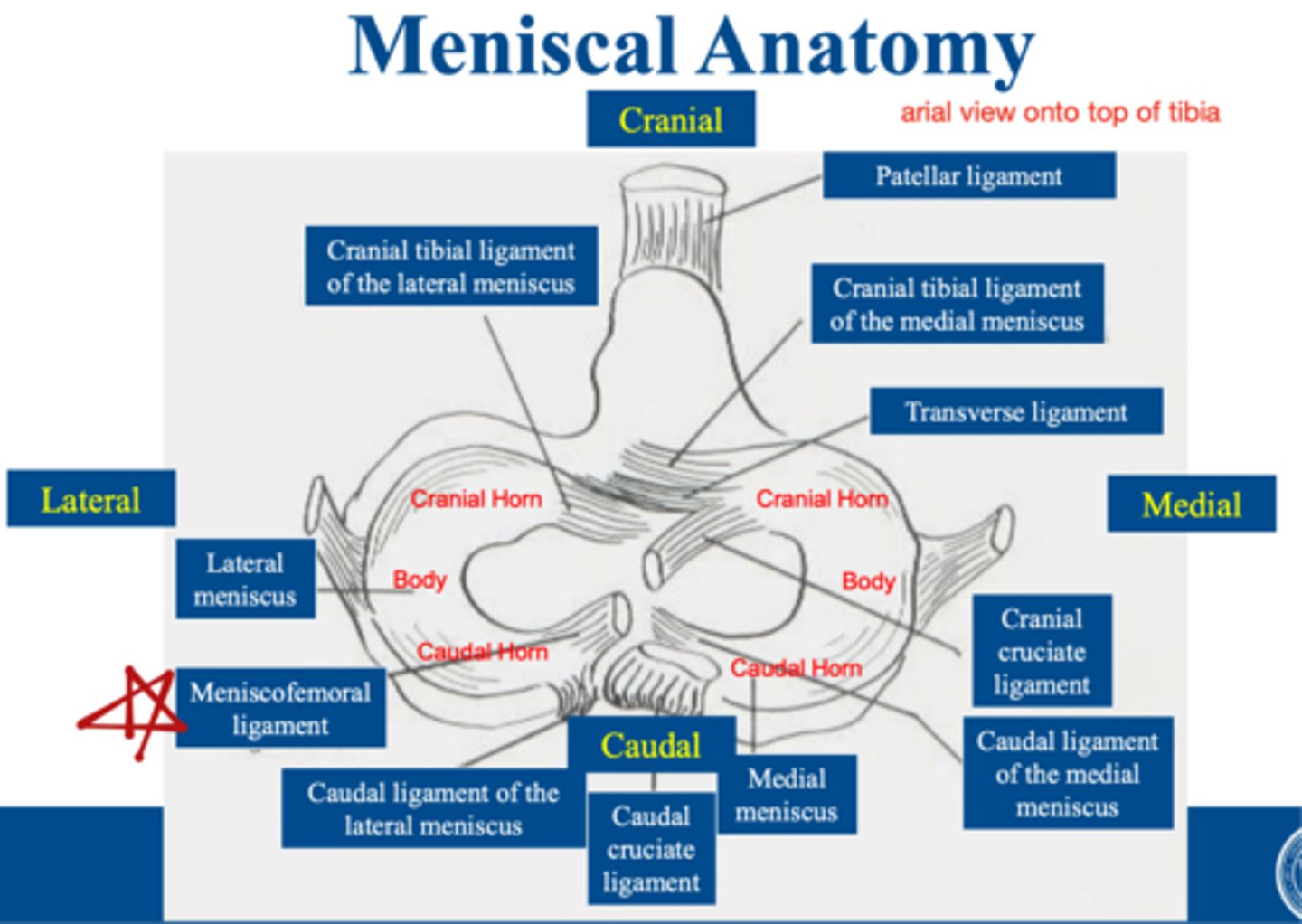<p>what structure firmly attached medial meniscus to joint capsule...makes the medial meniscus more likely to be damaged</p>