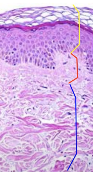 <p>Reticular layer</p>