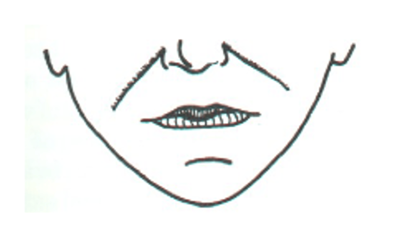 <p>may move laterally as it descends and terminate a relatively great distance from the line of closure</p>