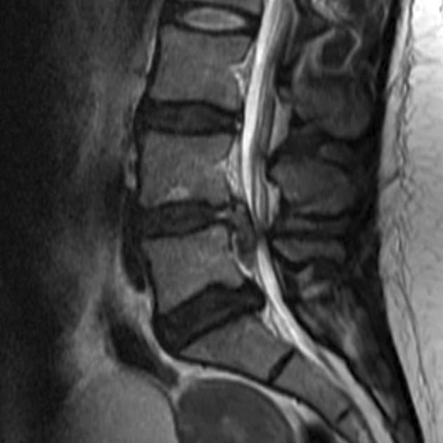 <p>Name this pathology. </p>