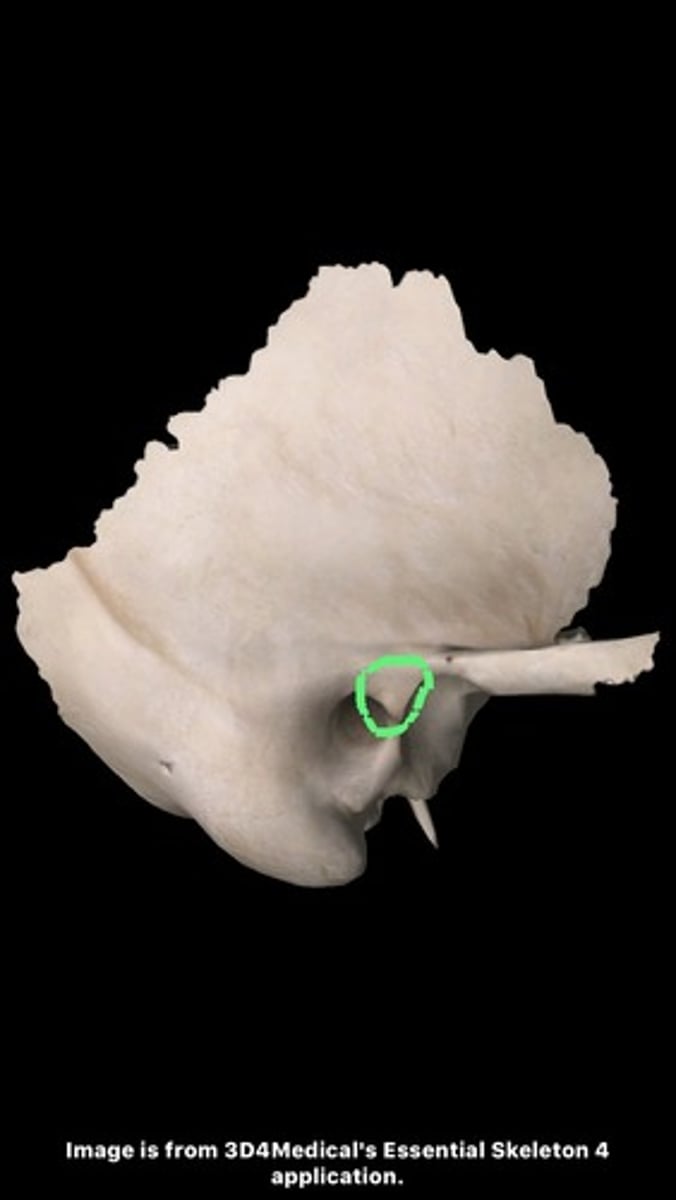 <p>projection that lies just anterosuperior to the EAM, interposed between the tympanic part (EAM and styloid process portion) of the bone</p>