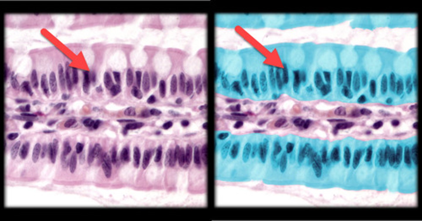 <p>- Single layer of tall, columnar cells without cilia.</p><p>- Nuclei are oval and aligned at the base of the cells.</p><p>- Absence of cilia gives it a smooth appearance under the microscope.</p><p>- Commonly found in the digestive tract, such as the stomach and intestines.</p>