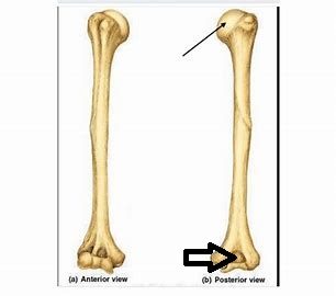 <p>what part of the scapula is this?</p>