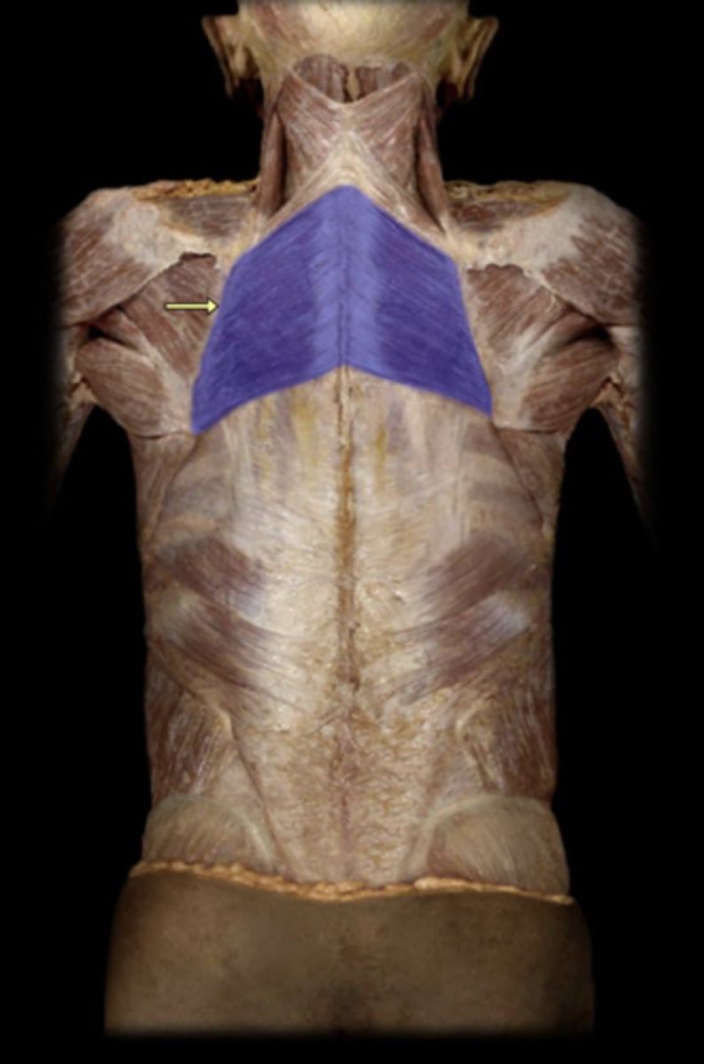 <p>action of rhomboid major</p>