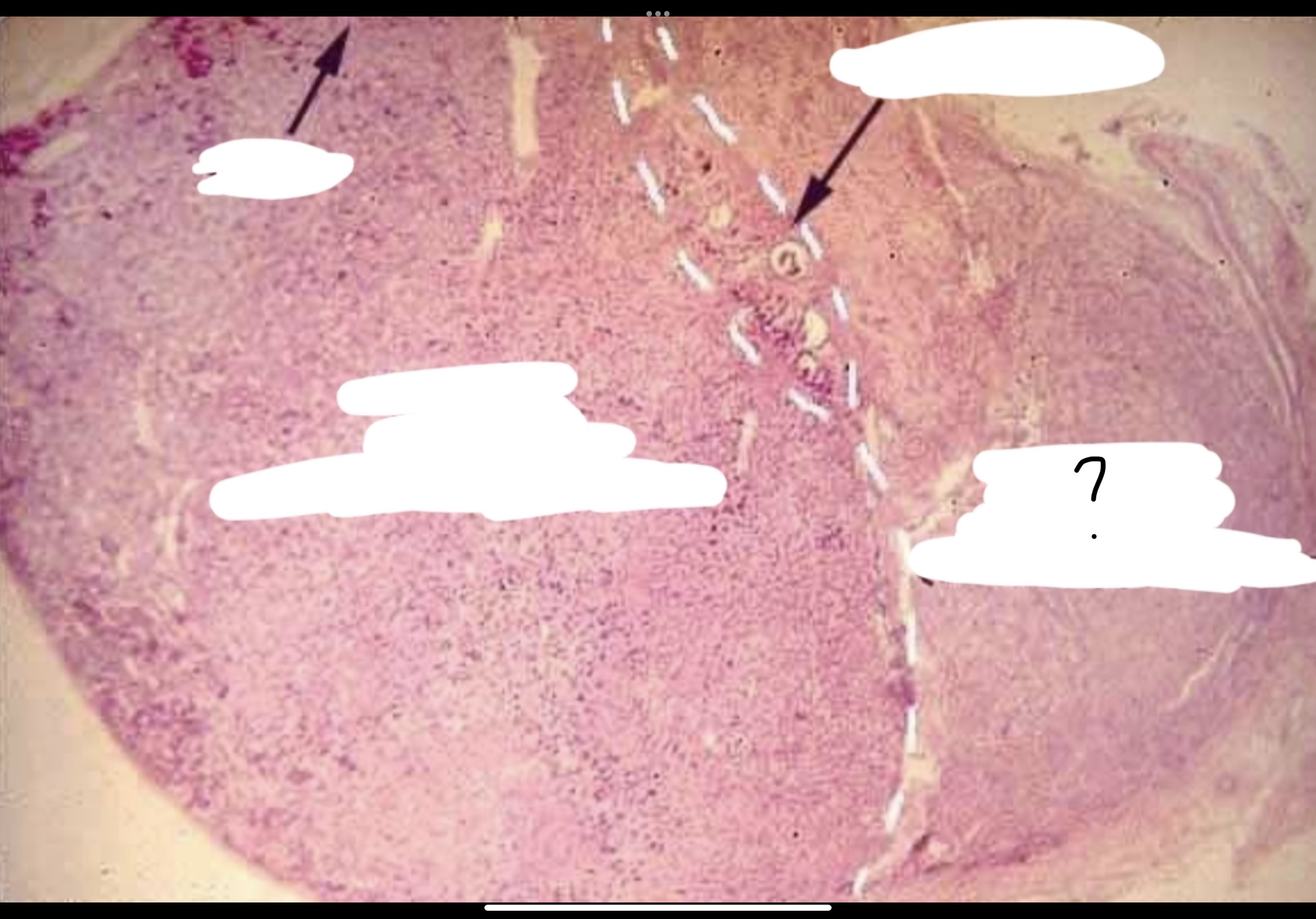 <p>What is the arrow pointing to?</p>
