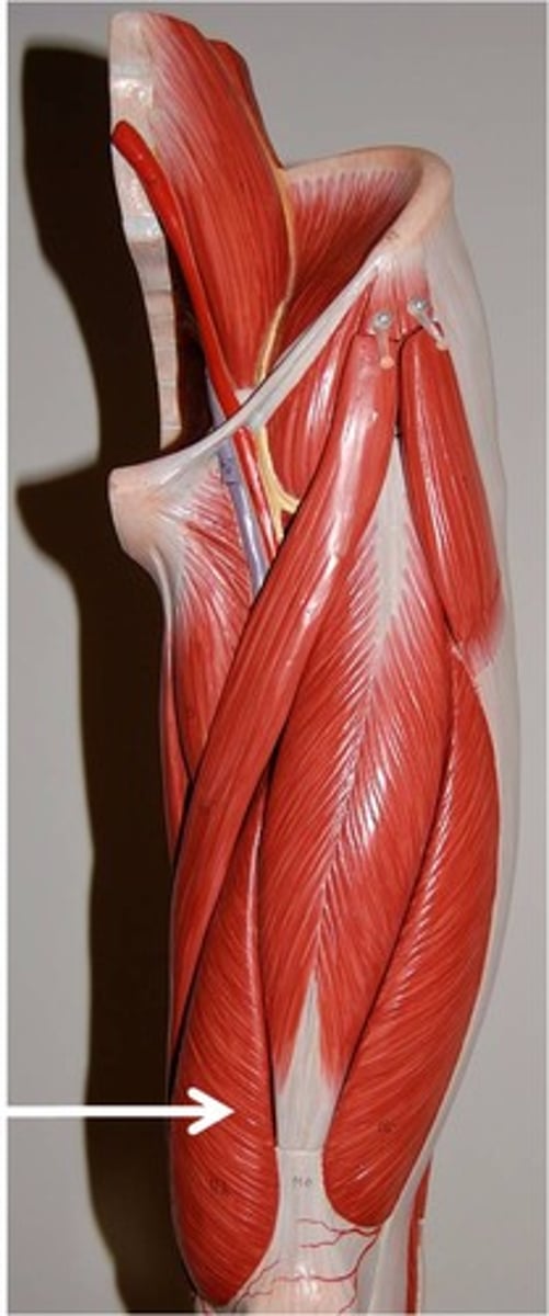 <p>Origin: Intertrochanteric line, spiral line and linea aspera, and the medial lip of linea aspera of femur<br>Insertion: Tibial tuberosity (via patellar ligament) and the patella itself<br>Action:Part of quadriceps femoris group, Flex the thigh and extend the knee</p>