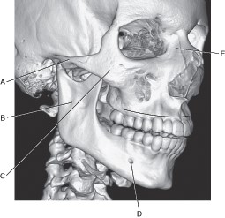 <p>Which line points to the ramus of the mandible?</p>