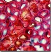 <p>What kind of Resolution error in photomicrography is this ? </p>