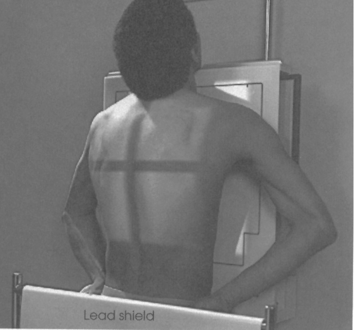 <p>pa chest&nbsp;</p><ul><li><p>72 SID</p></li><li><p>shoulders rolled forward </p></li><li><p>double inhalation </p></li><li><p>CR middle below scapula </p></li></ul><p></p>