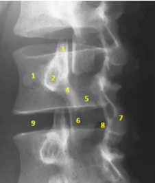 <p>findings + structures</p>