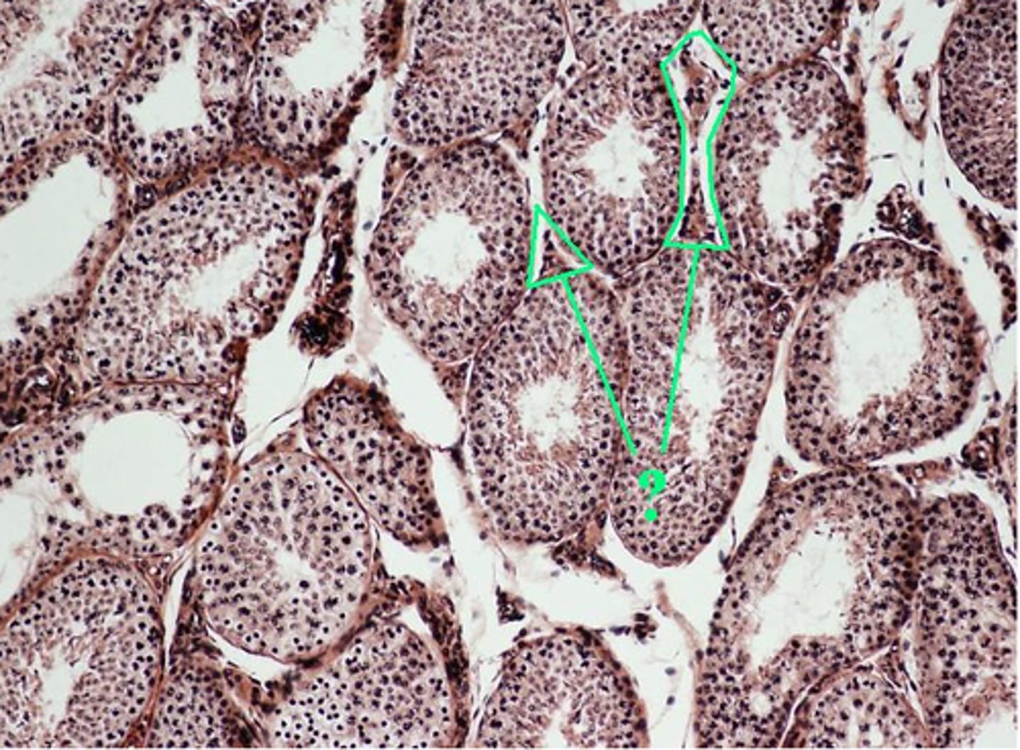 <p>What hormone producing cells are found in the indicated regions?</p>