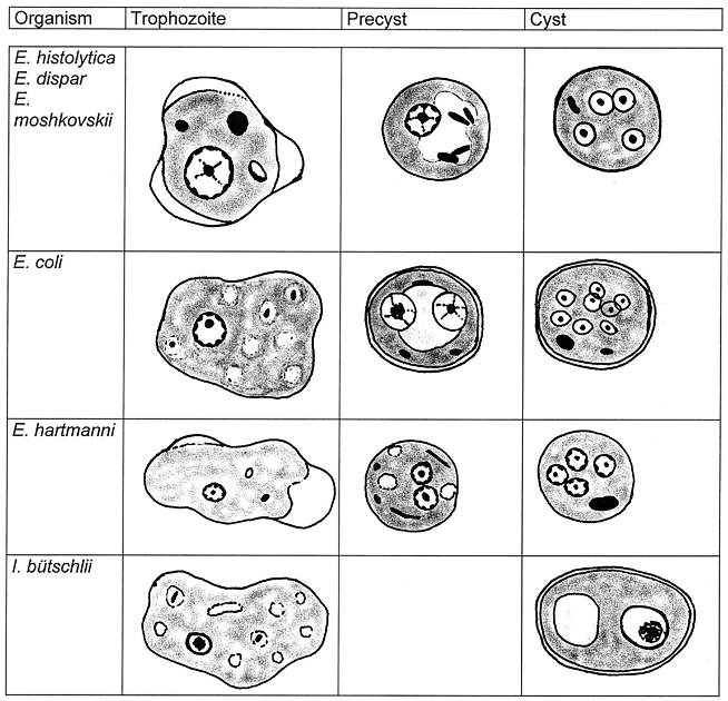 <ul><li><p>intestinal amoeba</p></li><li><p>can cause intestinal amebiasis or extraintestinal manifestations</p></li><li><p>amebic dysentary</p></li><li><p>liver abscses</p></li><li><p>amebic ulcerative pathology</p></li><li><p>like to eat RBC and neutrophils</p></li><li><p>Globally distributed: tropic areas but not limited to warm areas. More common in developing countries and areas of poor sanitation.</p></li><li><p>third leading cause of death</p></li><li><p>90% of those infected are asymptomatic</p></li><li><p>class b bioweapon</p></li><li><p>Morphology: Trophozoite (active)- only stage found in human, viable for 5 hours after infection, resistant to environmental changes. Pre-cyst stage (transitional)- can occur in lumen of gut or outside host, glycogen vacuole, 2 chromatid bars, begins dev cyst wall, trophozoites undergo encystment in feces. Cyst stage (infectious stage)- premature cyst has 1-4 chromatid bars, glycogen vacuole, and single nucleus. Mature cyst has no glycogen vacuole and is quidrinuclueated, resistant to high temp, acidity, ph, environmental conditions, and chlorine.</p></li><li><p>transmission: fecal-oral, anal, contaminated food/water, feet of flies can carry it, and poor sanitation.</p><ul><li><p>Steps: 1) Humans become infected when they ingest contaminated food or water carrying mature cyst. 2) cyst undergoes cytoplasmic division and excyst 4 small amoeba in small intestine lumen. 3)These 4 undergo cytoplasmic division and produce 8 small amoebae. 4) these 8 trophozoites travel to large intestine where they feed on host, mature, and reproduce. (EAT EVERYTHING)</p></li><li><p>In <strong>80% of infections</strong>, the trophozoites will <u>encyst in the lumen of the large intestine and be excreted.</u></p><p class="MsoListParagraphCxSpLast">In <strong>20% of infections</strong>, the trophozoites will <u>invade the mucosa and submucosa of the large intestine.</u></p><p><span style="font-family: Calibri, sans-serif">In <strong>1% of the cases</strong> the invasive trophozoites will cause <u>extraintestinal disease by going to liver.</u></span></p></li></ul></li><li><p>prevention: good hygeine, safe water and food especially when traveling, avoiding anal, and washing hands and fruits and veggies.</p></li><li><p>Diagnostic: Stool sample using wet mount and iodine and look for motile trophoziotes with phagocytosed RBC or cyst. E. dispar looks exactly like it so use PCR to distinguish. ELISA can also be used to differentiate but this is more expenisve but more accurate. U have to look at antibodies 2 weeks after infection.</p></li><li><p>screening: colonoscopy, CT scan, ultrasound</p></li><li><p>pathology: (attach, lyse, invade,, ulcer) use lectin glucose/ galactose to attach, release enzymes: phospholipase A and neuraminidase. Eat living cells (like RBC). Use CXCL8 to attract neutrophils to eat them and uses trogocytosis (nibbling of cells) to eat cells (like apoptosis).Use metacollagenase to spread through tissue and cause damage which causes inflammation and amebic ulercative pathology. (flask shaped ulcers are the hallmark)</p></li><li><p>Rx: cyst stage use paramycin and iodquinol. trophozoite stage use metronidazole.</p></li><li><p>Immune protection: secrete IgA to prevent lectin attachment and we release nitric oxide to protect.</p></li><li><p>Intestinal amebiasis- Diarrhea, dysenterya, chronic non dysentry diarrhea.</p></li><li><p>extraintestional amebiasis- liver abscess and brain damage.</p></li><li><p>amebic liver abscess- can cause fever and weight loss. Liver lesion produces anchovy past. Trophozoites present.</p></li><li><p><strong>Amebic Dysentery</strong> is a “bloody” mucoid diarrhea caused by:&nbsp;</p><p class="MsoListParagraphCxSpMiddle">o<span style="font-size: 7pt; font-family: &quot;Times New Roman&quot;">&nbsp; </span>bleeding into <u>gut lumen</u> and loss of overlying <u>gut mucosa.</u></p><p class="MsoListParagraphCxSpMiddle">o<span style="font-size: 7pt; font-family: &quot;Times New Roman&quot;">&nbsp; </span>resulting from adjacent <u>deep ulcers joining</u> (coalescing).</p><p class="MsoListParagraphCxSpMiddle">o<span style="font-size: 7pt; font-family: &quot;Times New Roman&quot;">&nbsp; </span>undermining the <u>overlying mucosal lining</u>.</p><p class="MsoListParagraphCxSpMiddle">o<span style="font-size: 7pt; font-family: &quot;Times New Roman&quot;">&nbsp; </span><strong>Can be fatal</strong>.&nbsp; Third deadliest disease bc in colon and losing blood and electrolytes.&nbsp;&nbsp;&nbsp;&nbsp;&nbsp;&nbsp;&nbsp;&nbsp;&nbsp;&nbsp;</p><p class="MsoListParagraphCxSpLast">-<span style="font-size: 7pt; font-family: &quot;Times New Roman&quot;">&nbsp;&nbsp;&nbsp;&nbsp;&nbsp;&nbsp; </span><strong>Necrosis</strong>:&nbsp; pathological death of cells resulting from irreversible damage.</p></li><li><p class="MsoListParagraphCxSpLast">symptoms: diarrhea, dysentry, fatigue, fever, excessive gas, rectal pain, and vomiting.</p></li><li><p class="MsoListParagraphCxSpLast"></p></li></ul><p></p>