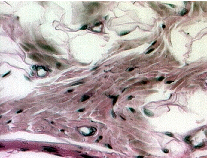 <p>Identify four capillaries in this slide.</p>