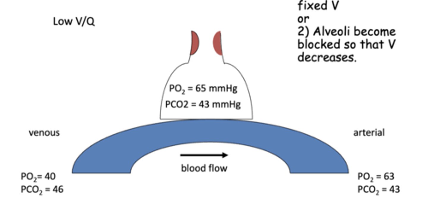 <p>decreased exchange of air w/ the atmosphere (decreased airflow) --&gt; drops PAO2 &amp; increases PACO2 because less O2 able to enter &amp; less CO2 able to be exhaled after gas exchange</p><p>*same changes reflected in the arterial end capillary</p>