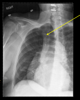 <p>what type of tube is this?</p>