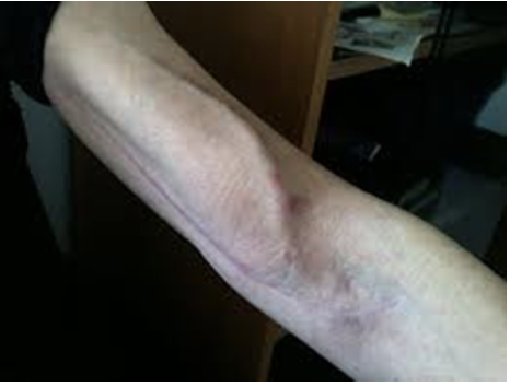 <ul><li><p><span>What is this image showing? </span></p></li><li><p><span>How do you assess this item?</span></p></li><li><p><span>Do you or do you not want a bruit and thrill to be present?</span></p></li></ul><p></p>