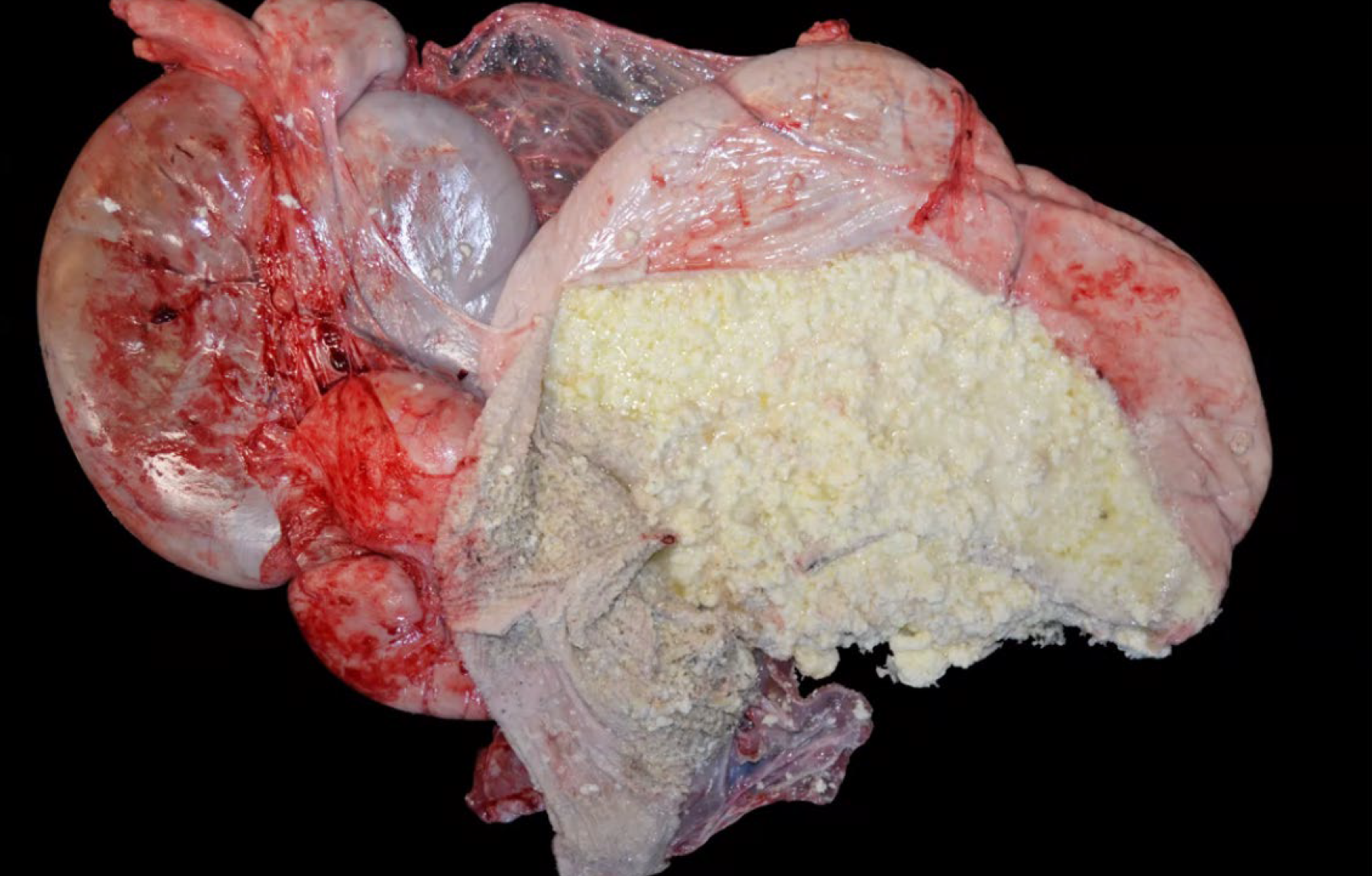 <p>Newborn calf. What is the condition?</p><p>A-Zygomycosis</p><p>B-Ruminal drinker</p><p>C-Bovine viral diarrhea</p><p>D-lnfectious bovine rhinotracheitis</p>
