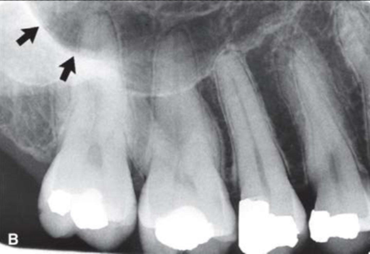 <p>Identify the structure</p>