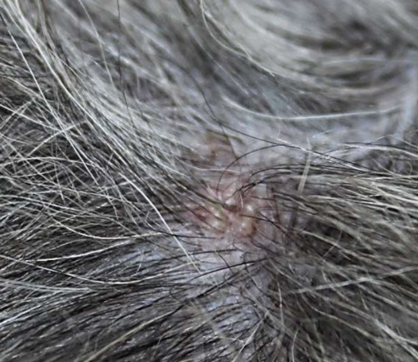 <p>¿lesión?</p><p>¿primaria o secundaria?</p>