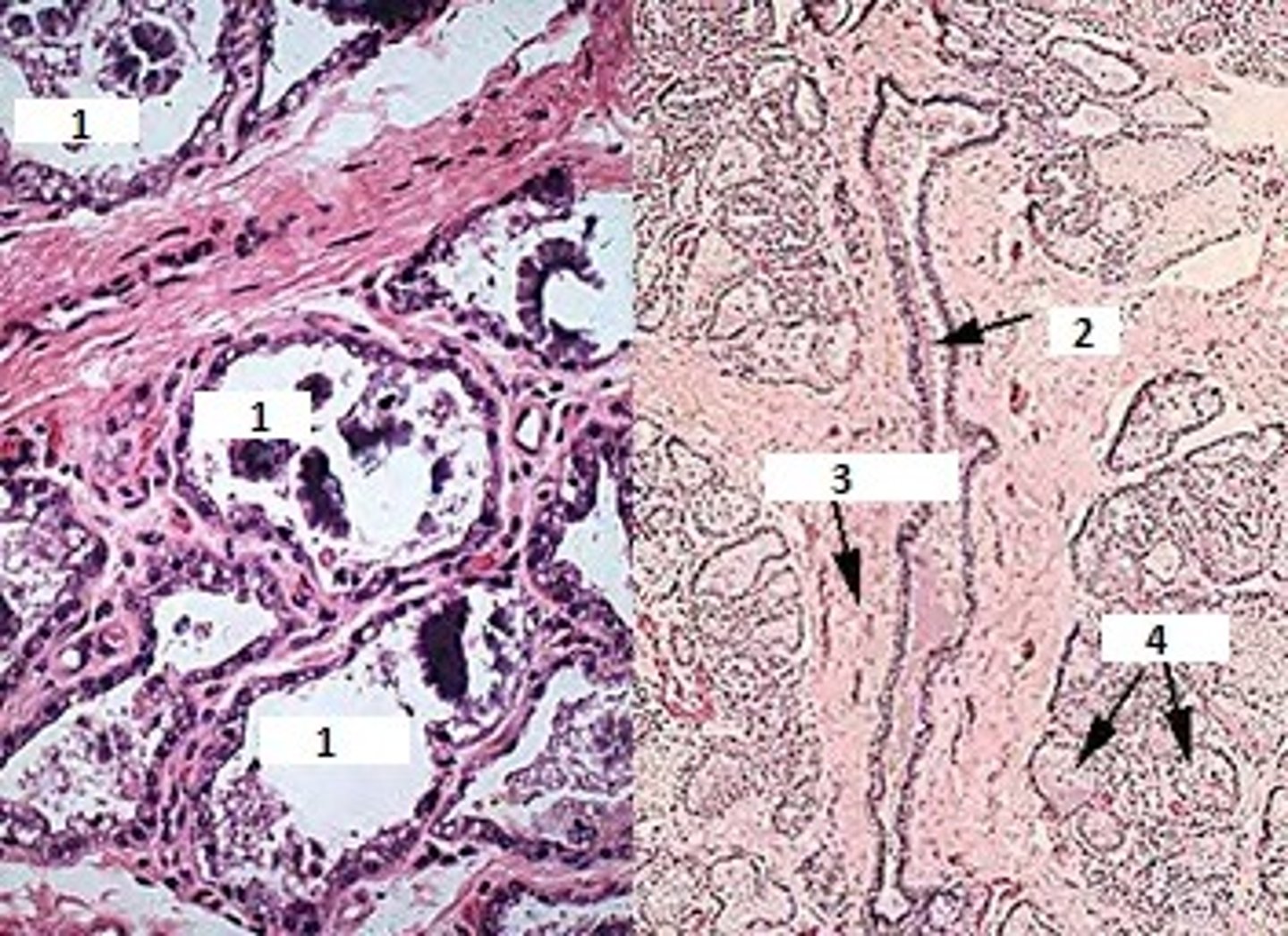 <p>Identify the organ &amp; 1-4. Describe the epithelium lining #1 and its method of secretion</p>