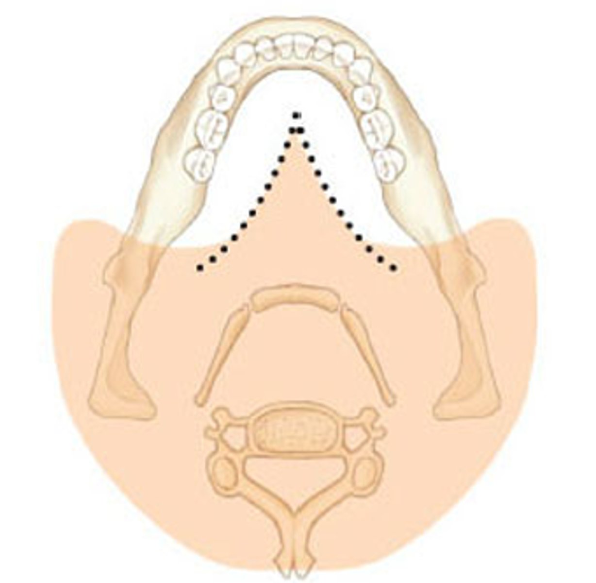 <p>The structures outlined in orange indicate what type of image?</p><p>A) real image</p><p>B) double real image</p><p>C) ghost image</p>