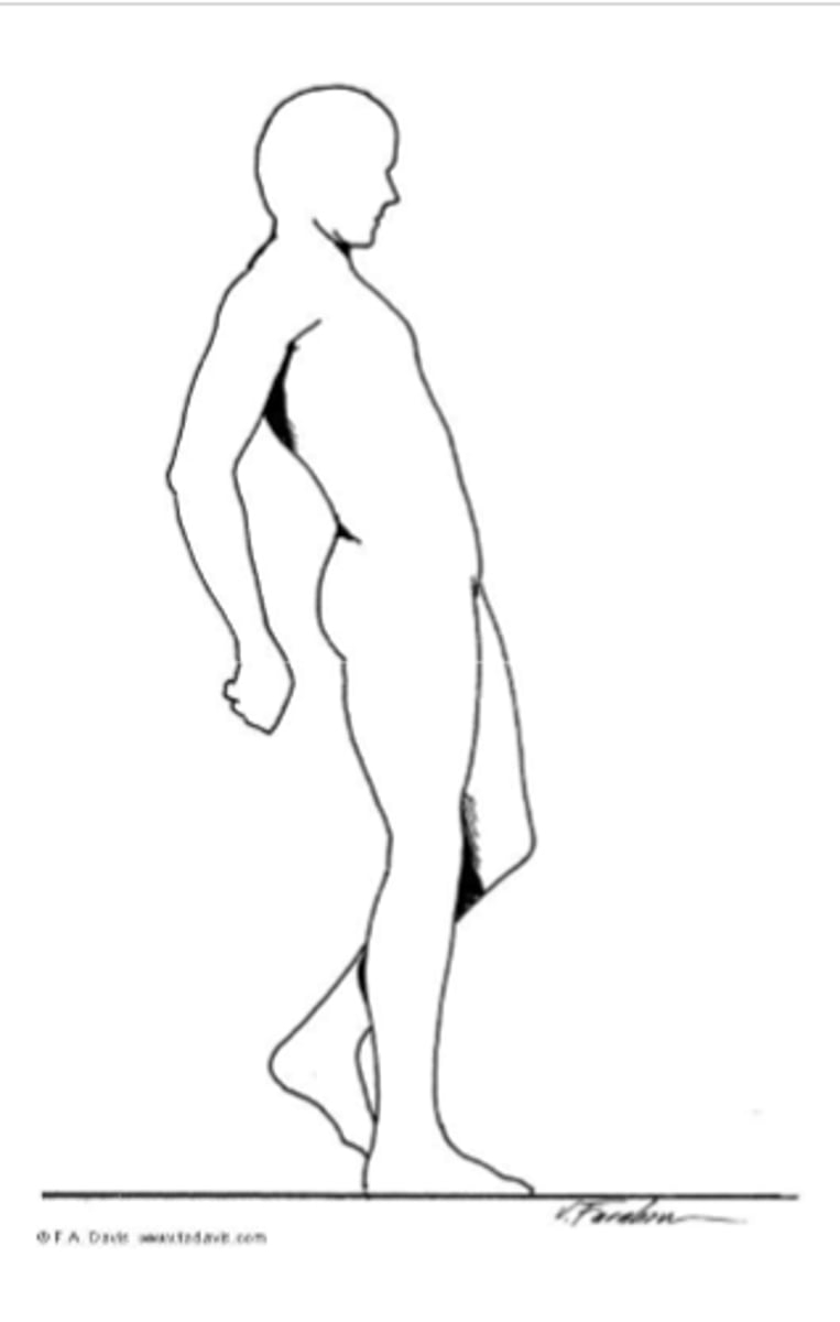 <p>muscular involvement</p><p>weakness - results in Gluteus Maximus gait</p><p>*backward lean to compensate for weakness</p>