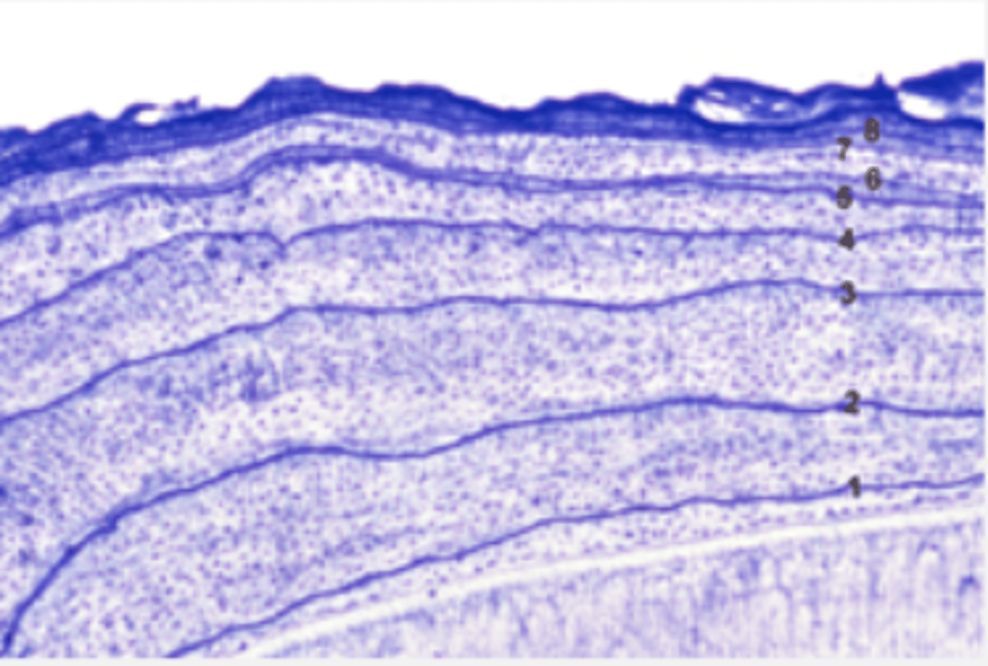 <p>formation of cementum on root surface (blast cells)</p><p>purple is arrest lines that occur in intervals</p><p>only adjacent to vital connective tissue</p>