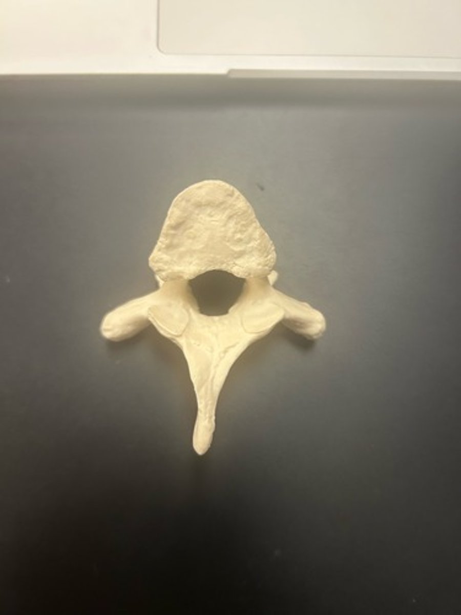 <p>name the bone</p>