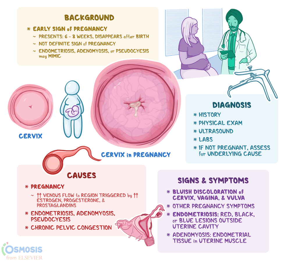 <p>chadwick sign</p>