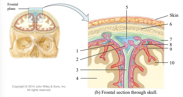 <p>locate the falx cerebrae that lies in the dura mate in longitudinal fissure</p>
