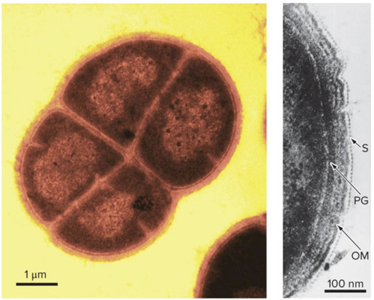 <p>tough (resistant to drying out and radiation); can be spherical or rod shaped; stains as a gram positive (purple in color) but is gram negative due to second membrane</p>