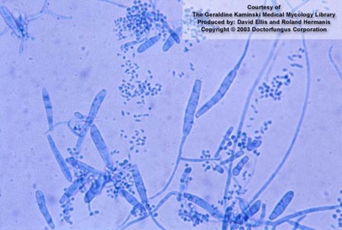 <p>Causes athletes foot</p>