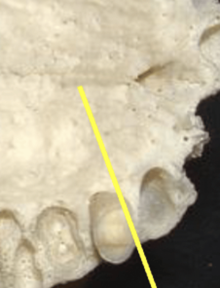 <p>palatine process</p>