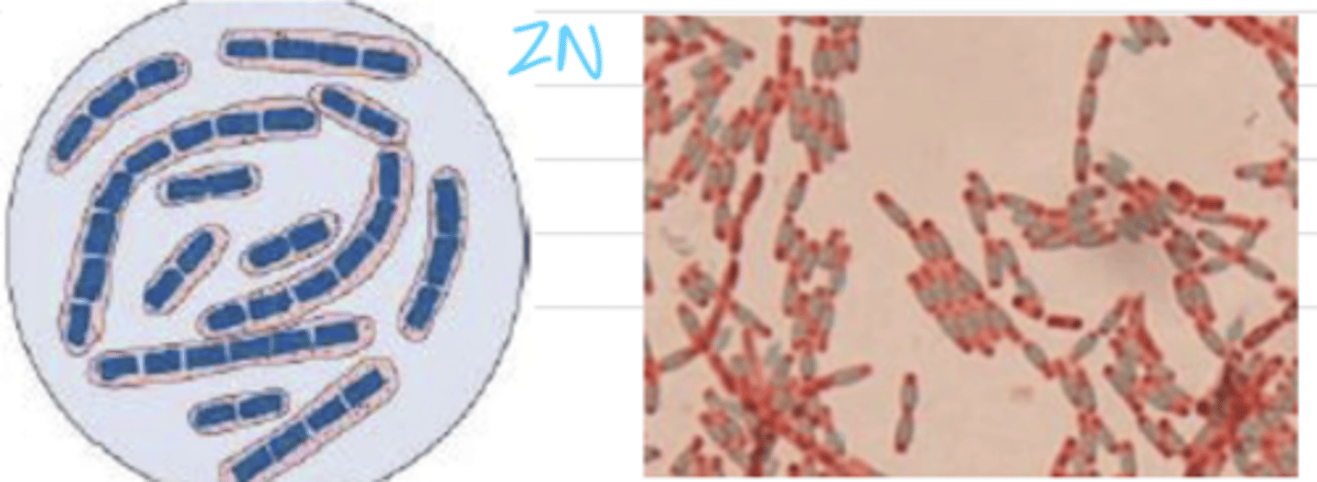 <p>which bacteria appears like this with the ZN stain?</p>
