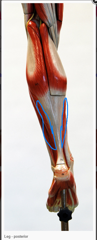 <p>what is the name of the muscle that is circled </p>