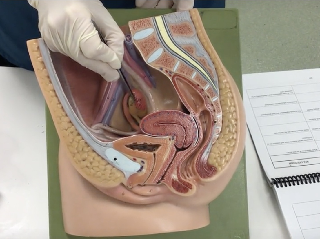 <p>Description: Mobile, finger-like projections at distal end of uterine tube</p><p>Relationship: Guide released ovum into the uterine tube</p>