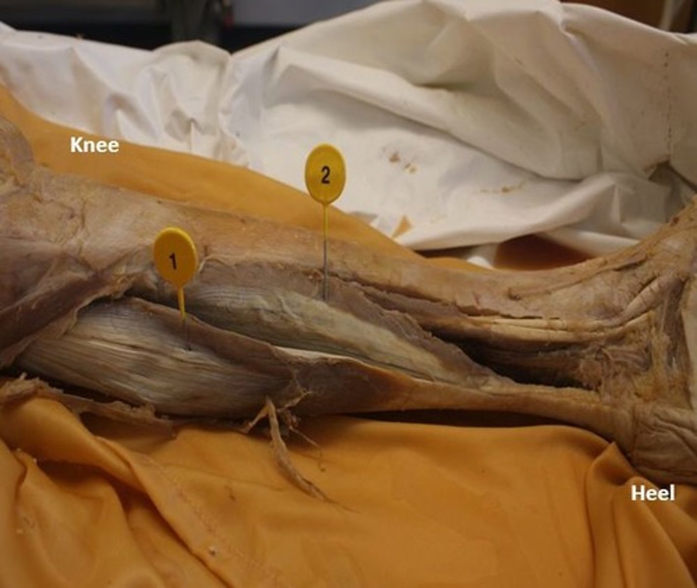 <p>2, deep to gastrocnemius</p>