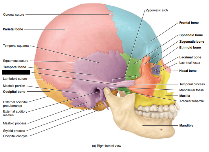 <p>State and identify what part of the cranial bone is being pointed out and censored. </p>