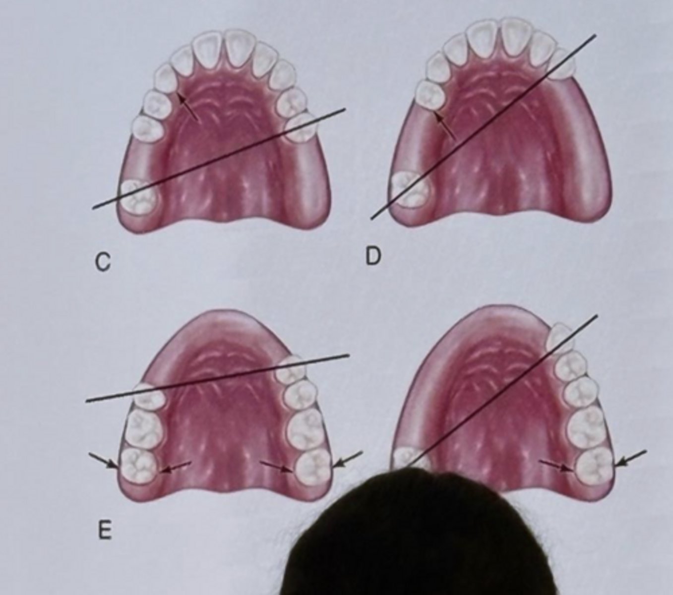 <p>C. The first statement is correct, and the second statement is incorrect</p>